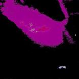 28954749